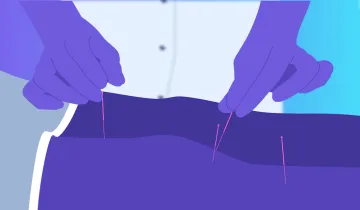 Acupuncture Marketing Tips