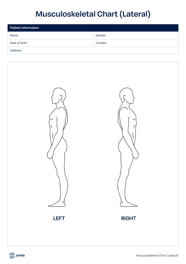 Preview of the Lateral (Side View) body chart template