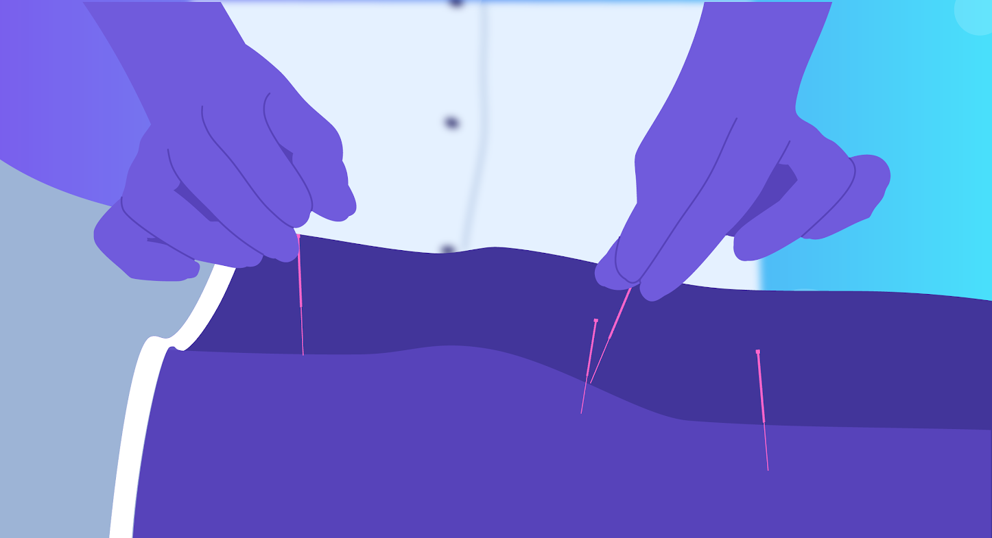 Acupuncture Marketing Tips